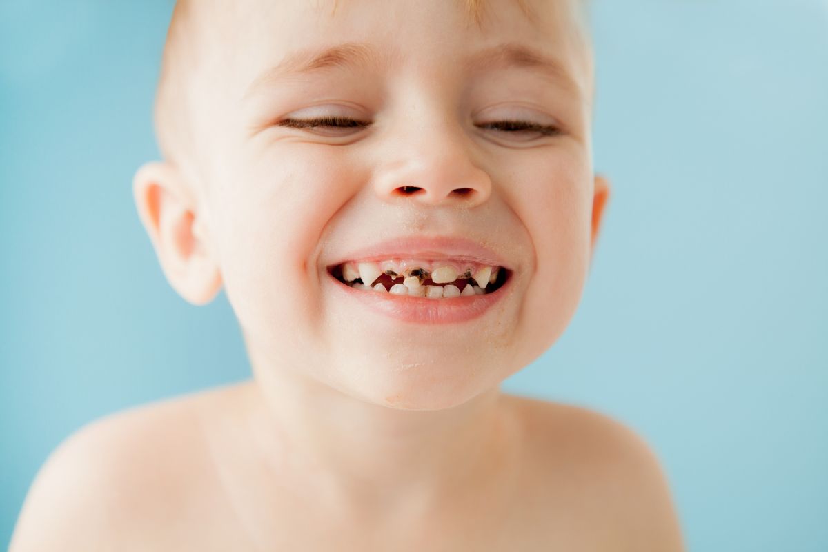 caries-ninos
