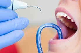profilaxis dental