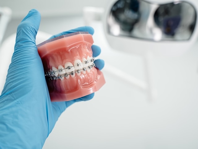 ortodoncia brackets
